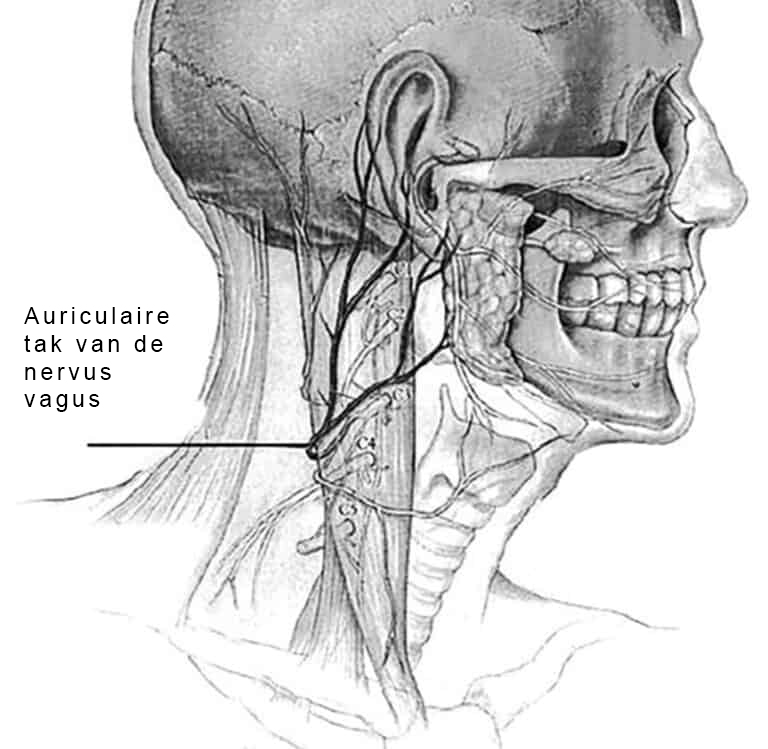 Nervus vagus stimulatie piercing NVS